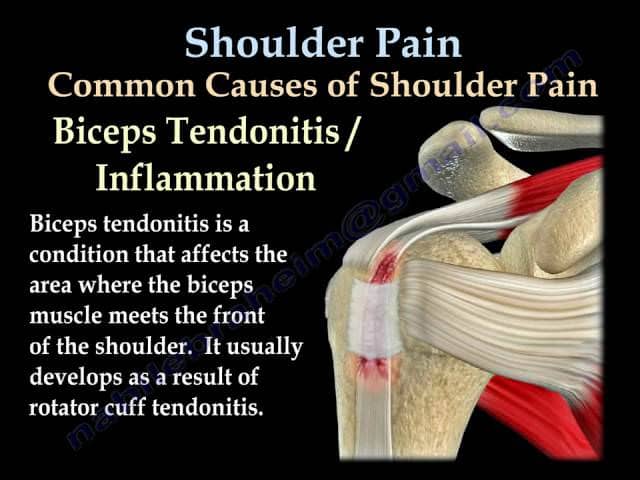 what causes shoulder joint pain